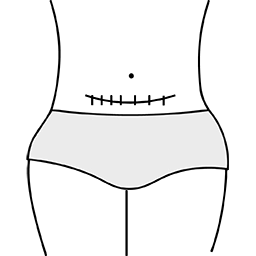 icon-caesarean sections